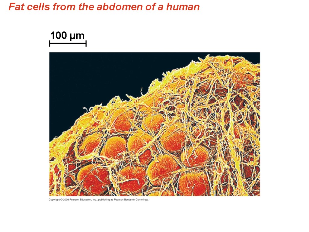 Fat cells from the abdomen of a human 100 µm